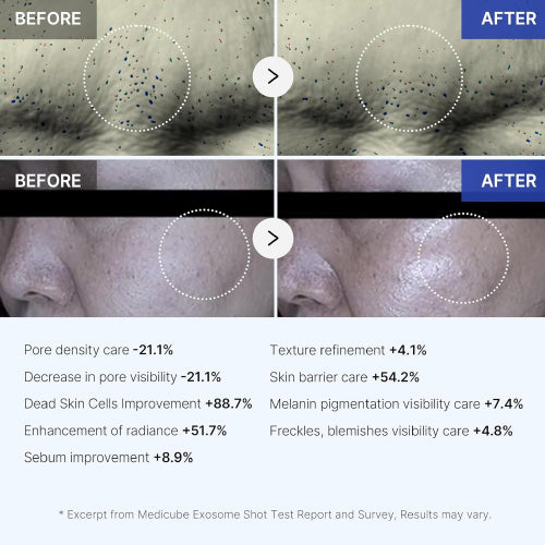 Medicube One Day Exosome Shot Pore Ampoule 2000